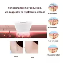Handheld Ipl Laser Epilator Painless Facial Hair Removal Machine Portable Household Painless Permanent Laser Epilator For Body